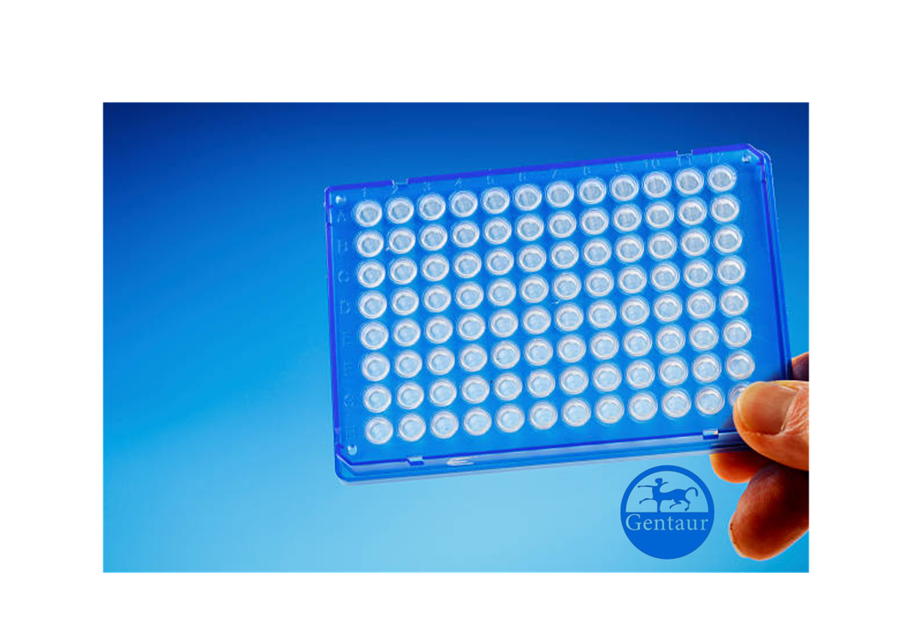 ELISA   ACSF2 Antibody, FITC  
