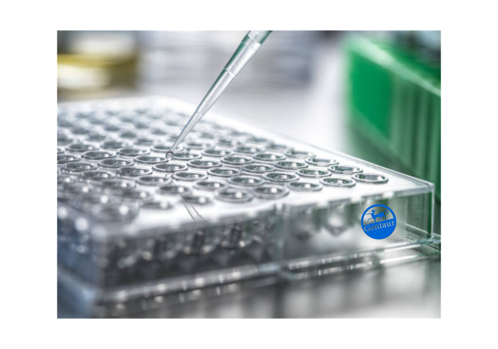 ELISA   67kDa Laminin Receptor anti-